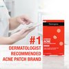 Neutrogena Stubborn Acne Blemish Patches, Ultra-Thin Hydrocolloid Acne Patch Absorbs Fluids & Removes Impurities To Help Pimples Look Smaller After One Use, 2 x 24 Patches, (48 Patches)