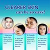 CLERZENA Star Pimple Patches for Face | Star Acne Patches Cute | Pimple Patches Salicylic Acid, Tea Tree Oil and Calendula Oil | Pimple Patch Star Teen Acne Treatment for Girls