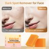 HOYEHOLA Kojic Acid Turmeric Soap Bar - Dark Spot Remover for Face Even Skin Tone, Moisturizing & Nourishing Natural Ingredients 2Pack