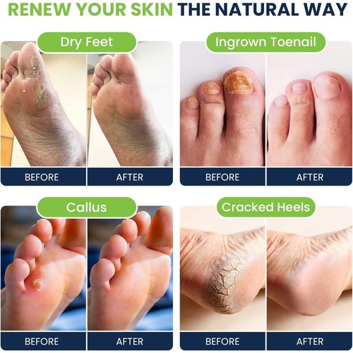 Tea Tree Oil & Muscle Relief Foot Soak with Epsom Salts - All Natural Salts for Post Workout Recovery - Softens Calluses, Soothes Sore & Tired Feet, Foot Odor Scent, Spa Pedicure Made in USA Pack of 2