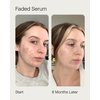Topicals Faded Starter Kit, The Brightening & Clearing Bundle - Faded Serum for Dark Spots (0.5oz) and Faded Under Eye Masks (Set of 6)