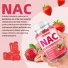 Mchokuu NAC Gummies for Adults & Kids 1000mg, NAC Supplement N-Acetyl Cysteine, Immune Support Liver & Lung Health Antioxidant Sugar-Free, Strawberry Flavor Gummy, 60 Counts