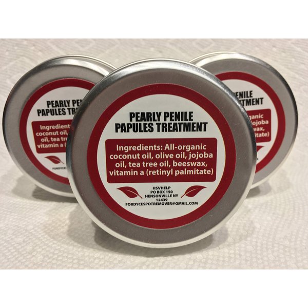 Pearly Penile Papules Removal Cream - Fordyce Spots treatment for Pearly Penile Papules