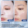Deep Collagen Anti Wrinkle Lifting Mask, Collagen Face Mask, Deep Collagen Anti Wrinkle Lifting Mask Collagen Face Mask Overnight, Deep Collagen Mask for Lifting, Firming, Moisturizing (5 Pack)