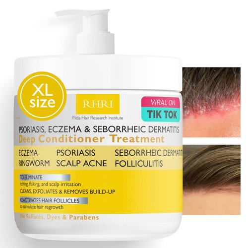 Antifungal Psoriasis Deep Conditioner Treatment, Eczema, Seborrheic Dermatitis | Soothes Itching, Flaking & Irritation | Repairs Scalp, Strengthens Hair, Stimulates Regrowth