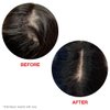 HAIRtamin Scalp Serum Natural Hair Treatment | Visibly Increases Thicker Looking Hair and Promotes Scalp Health | Nourishes & Hydrates Dry, Itchy Scalp (Two Pack)