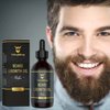 Beard Growth Oil with Biotin – Thickening and Conditioning Beard Oil Growth - Natural Beard Serum for Facial Hair Growth for Men by Striking Viking (Sandalwood, 2 Fl Oz (Pack of 1))