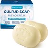 Roycederm Sulfur Soap for Acne Support: Sulfur Face Wash Bar for Sensitive Skin and Blemish-Prone Areas - Sulfur Body Cleanser with 10% Volcanic Sulfur, Tea Tree Oil - 2 Bars