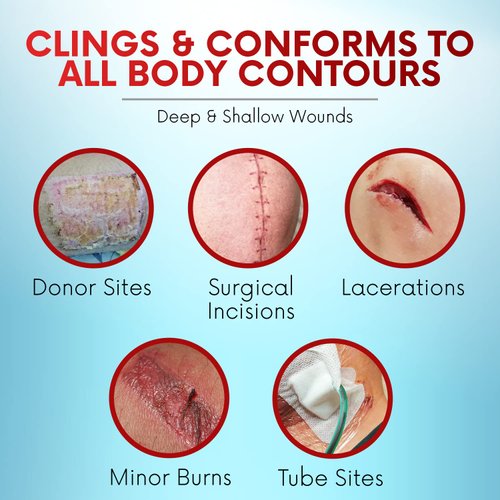 HEALQU Medical Xeroform Petrolatum Dressing 4x4-25-Count - Non-Adherent Gauze Pad for Low Exudating Wounds - Fine Mesh Gauze Patch Sterile for Wound Care Lacerations, Burns & Skin Grafts