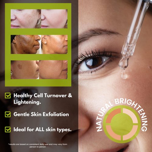 Extra Strength Kojic Acid Serum 7.5% Vitamin C Infused Dark Spot Corrector For Face And Body