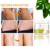 Dursie- Best Effective Scar Removal Cream After Pregnancy Stretch Marks Treatment for Women. Paraben-Free, Hypoallergic, and Safe for Pregnancy (5oz)