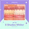 Smileactives Teeth Whitening Products- Prolite LED Teeth Whitening Kit at Home Accelerated Teeth Whitener Kit for White Teeth