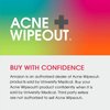 Acne Wipeout Oil-Free Pore Cleanser - Acne Treatment for Acne Prone Skin with Shine Control and Jojoba Gel. Gently Exfoliates to Deliver Micronized 2.5% Benzoyl Peroxide Treatment into Pores, 4 fl oz