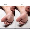 4 Pieces Double Sided Foot File Callus Remover Foot Sander Foot Scrubber Dead Skin Remover Pedicure Tools
