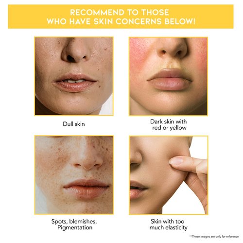 #OOTD Potent Vitamin C Serum [1.69 Fl Oz]: Vitamin C Serum for face dark spots, hyperpigmentation serum, ascorbic acid, vitamin tree water, brightening, Made in Korea