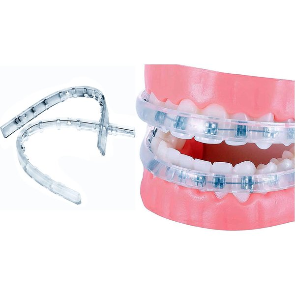 Clip on Comfort Covers for Braces - Braces Cover - Lip Protector - Dental Wax Alternative - Braces Mouthguard for Teeth