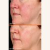 Dr. Dennis Gross Vitamin C Lactic 15% Vitamin C Firm & Brighten Serum: Visibly Improve Signs of Aging, 1 oz