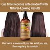 Ultikare Ginger Shampoo for Dandruff Hair, Anti-Dandruff Treatment - Itchy Dry Scalp Care Shampoo Ginger Extract Oil Strengthen Hair Formula, for Men and Women