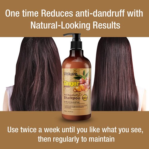 Ultikare Ginger Shampoo for Dandruff Hair, Anti-Dandruff Treatment - Itchy Dry Scalp Care Shampoo Ginger Extract Oil Strengthen Hair Formula, for Men and Women