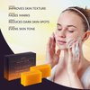 VALITIC Kojic Acid Vitamin C and Retinol Soap Bars with Turmeric for Dark Spot - Original Japanese Complex Infused with Collagen, Hyaluronic Acid, and Vitamin E (4 Pack)