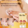 Natural Honey Bee Venom Repair Cream,Bee Venom Treatment Cream Remove Spots,Bee Venom Hydrating Moisturizing Cream,Professional Gel Joint Cream Soothing for All Parts of the Body(3)