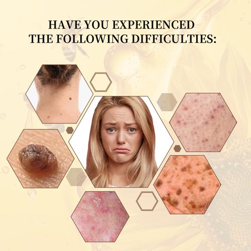 Bee Venom Repair Cream,Bee Venom Moisturizing and Nourishing Cream,Professional Bee Venom Repair Cream,Bee Venom Treatment Cream for All Parts of The Body,Suitable for All Skin Types of Men and Women