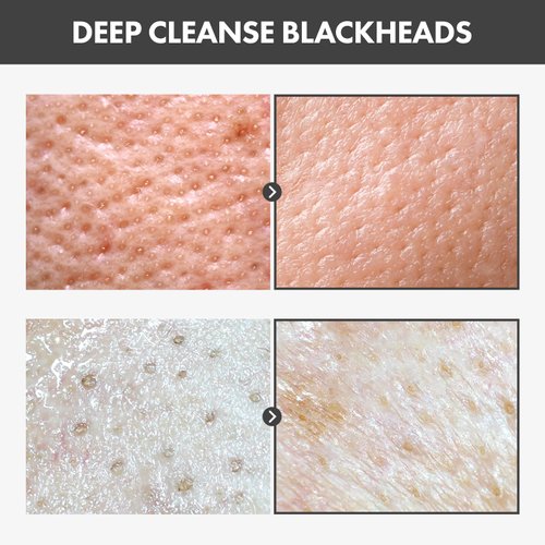 TOSOWOONG Blackhead Peel Off Pack, Charcoal Face Mask Peel Off for Blackheads and Pores, Deep Pore Cleansing, Pore Extractor Exfoliating mask, Korean Skincare, 50g, 1.76 oz.
