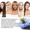 VXHDAG Black Seed Oil Capsules - Cold Pressed Black Seed Hair Repair Oil With Keratin and Multivitamins for Dry Damaged Hair Antioxidant, High Thymoquinone, 40 Capsules