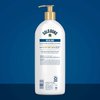 Gold Bond Healing Hydrating Lotion, 20 oz., With Aloe, Moisturizes, Immediate 24-Hour Hydration