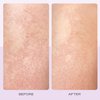 First Aid Beauty - KP Bump Eraser Body Scrub with 10% AHA, Keratosis Pilaris Exfoliating Skin Cleanser with 10% Lactic Acids Glycolic, Pumice & Bisabolol, Reduces Bumps, Strawberry Scent, 2 oz