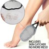 2 Pcs Foot Files with Skin Catcher, Stainless Steel Foot Rasp Callus Remover Pedicure Feet Grater Foot Scrubber Dead Skin Remover for Feet