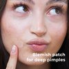 OMMA Micropoint Acne Patch, Cystic Acne Patches | Efficient Pimple Patches Microneedle, Dark Spot Patches for Early-Stage Painful Zits | Korean Pimple Patch with Salicylic Acid | 18 Zit Stickers