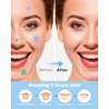 Star-Shaped Pimple Patch Hydrocolloid Acne Stickers with Tea Tree Oil + Salicylic Acid, Cover Dot for Acne Blemish, Pimples, Whiteheads, Zit, Draw out Oil & Impurities, 112 Dots, 14mm & 10mm