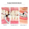 3Pcs Tooth Stain Remover, Teeth Cleaning Calculus Tool, Professional Teeth Whitening Polishing Cleaning Kit, Not Electric Cleaner Brush(White)