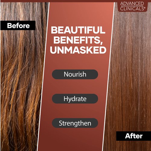 Advanced Clinicals Castor Oil Conditioning Hair Mask Natural Detangler & Hair Treatment W/Jamaican Black Castor Oil, Coconut Oil, & Biotin Repair For Color Treated, Dry, Or Damaged Hair, 12 Fl Oz