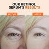 Retinol Serum for Face, Retinol Eye Cream, Hyaluronic Acid Serum 3PCS, Anti Aging Serum Skin Care Set for Women