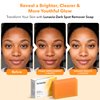 lunavia Kojic Acid Dark Spot Remover Soap Bar with Vitamin C, Turmeric, Retinol, Collagen & Hyaluronic Acid – Brightening Face & Body Soap – Fade Dark Spots, Even Skin Tone – 3 Pack