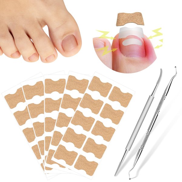 50 Pcs Breathable Corrector Patch, Professional Pedicure for Ingrown Toenail, Ingrown Toenail Corrector Patch 2 Pedicure Tools, Not easy to fall off