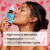 SeoulCeuticals Korean Acne Serum, Skin Care Treatment for Acne Prone Skin - Rapid Action Salicylic Acid, Tea Tree & Clove For Even Skin Tone 1oz