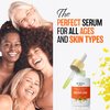 NETINA Skin Restart Dark Spot Serum - Turmeric, Niacinamide, Vitamin C, 30 mL