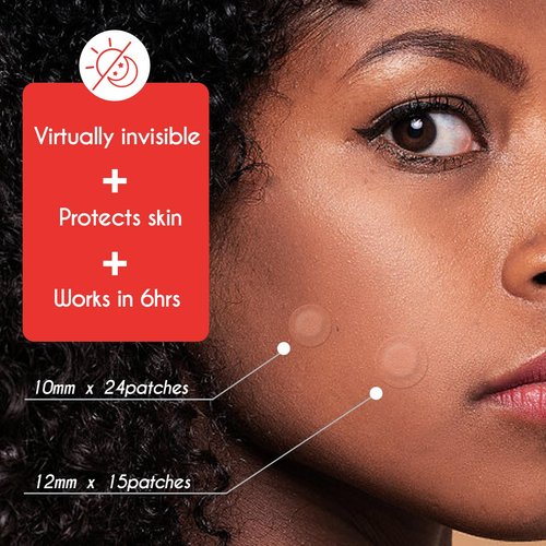 ZHAOLIESM Pimple Patches for Face, Hydrocolloid Acne Patch - Clear Invisible Spot Cover, Blemishes, Zits Oil Absorbing Patch, Breakouts Spot Treatment for Skin Care, Facial Sticker (54 Count)