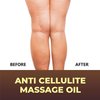 First Botany, Anti-Cellulite Massage Oil Infused with Collagen & Stem Cells - Natural Cellulite & Stretch Mark Treatment for Men & Women - 8 oz