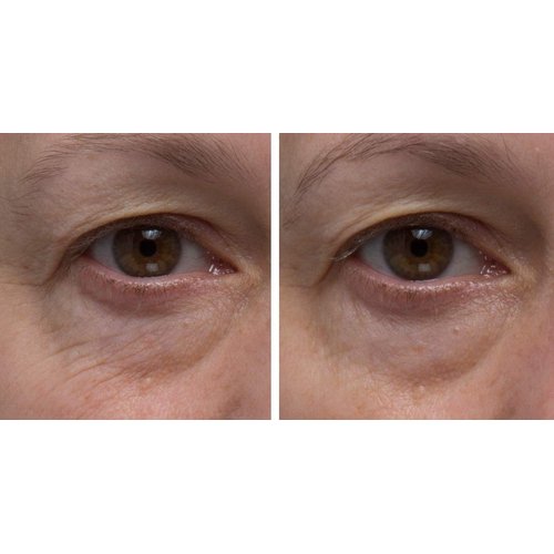 Dr. Denese SkinScience Firming Facial Collagen Eye Cream Face Moisturizer Hyaluronic Acid & Peptides Rejuvenate Skin - Improved Look of Fine Lines, Elasticity, Sagginess, Bags - Cruelty-Free - 1oz