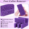 JEFHOMKIT Foot Pumice Stone,40 PCS Pumice Stone for Feet,Disposable Foot Scrubber Pumice Pads,Pumice Stone Dead Skin Callus Remover for Feet,Sponge Pedicure Stone for Nail Salon Home Use(Purple)