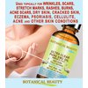 Botanical Beauty PURE EMU OIL ULTRA CLEAR 100% Natural REFINED for FACE, SKIN, BODY, HANDS, FEET, NAILS, HAIR, LIP CARE 0.5 Fl. oz. - 15 ml
