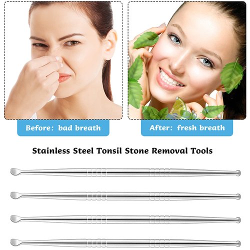 Nuanchu 4 Pieces Stainless Steel Tonsil Stone Removal Pick Tonsillolith Tool Oral Cleaner to Get Rid of Bad Breath