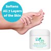 Banish My Callus Foot Callus Cream Hand Callus Remover – For Softening Rough Hard Dry Skin on Feet Hands Knees Elbows