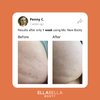 EllaBella Ms. New Booty Scrub - Walnut Exfoliator, Acne Treatment | Reduce Keratosis Pilaris