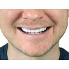 Instant Smile Flex 2pk - Bright White Shade - One Size Fits Most. Fix Your Smile at Home in Minutes! Comfortable Upper Cosmetic Veneer for A Perfect Smile!