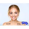 Eye See Plush Gel Eye Mask for Puffy Eyes, Blue - Cold Eye mask to Treat Dark Circles, Sinuses, Dry Eyes, and for Allergy Relief - Microwave Safe for Heat Therapy
